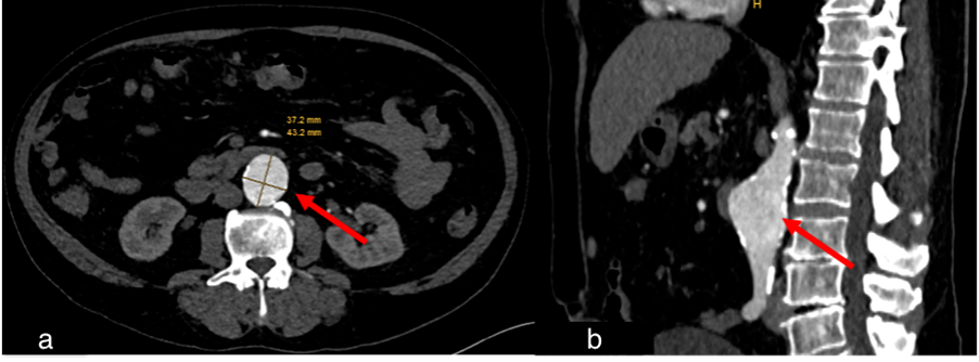 Diagnostics 15 02832 g008