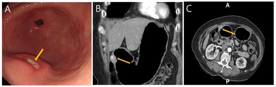 Diagnostics 15 02865 g001