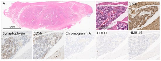 Diagnostics 15 02865 g002