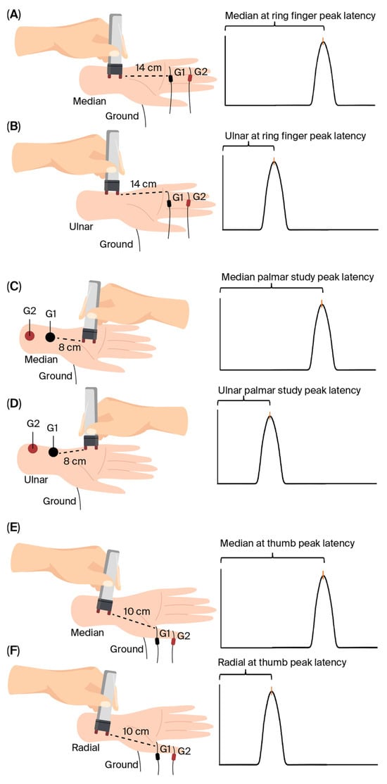 Diagnostics 15 02888 g001