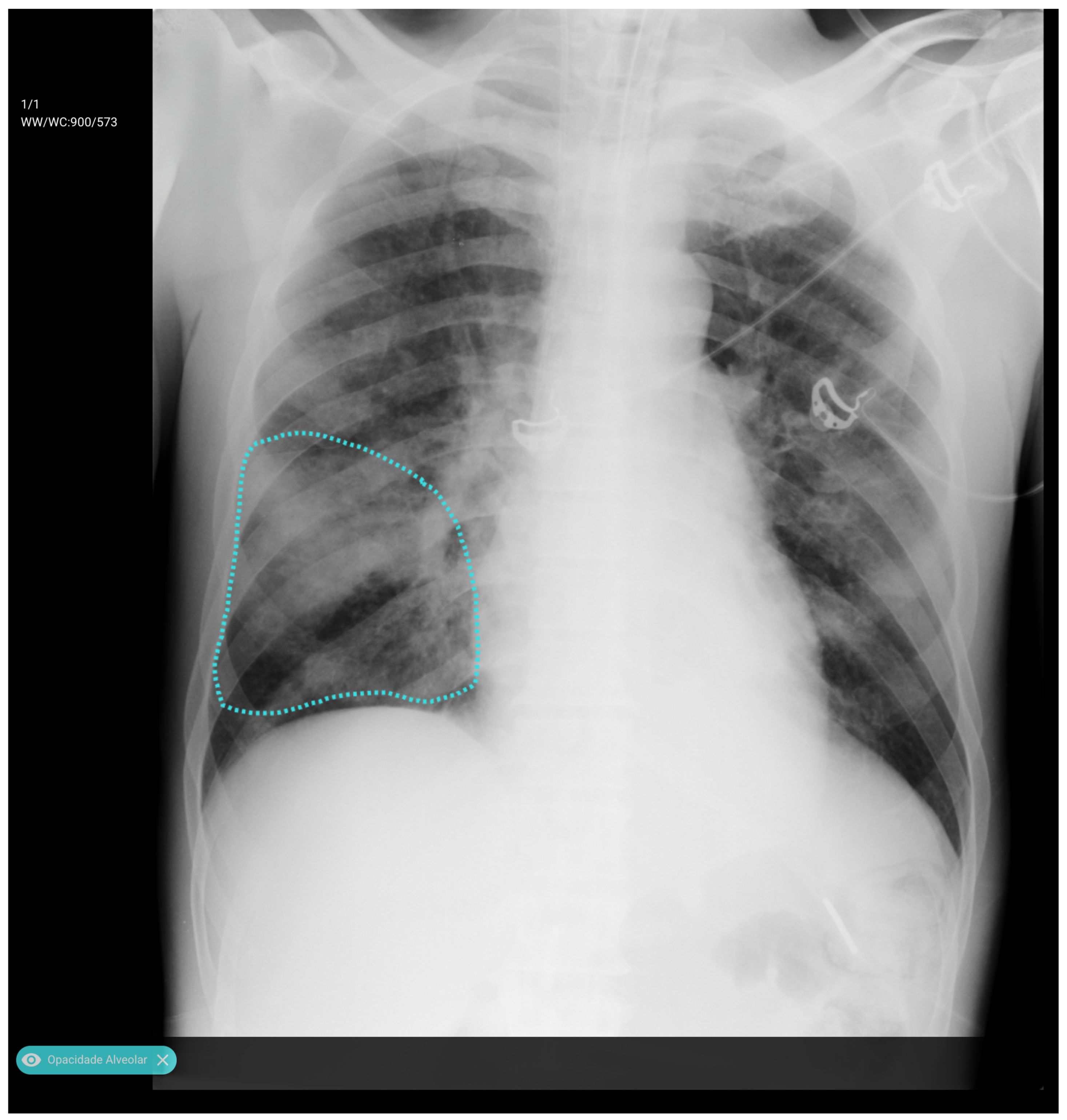 Diagnostics 15 02899 g001 Diagnostics 15 02899 g001