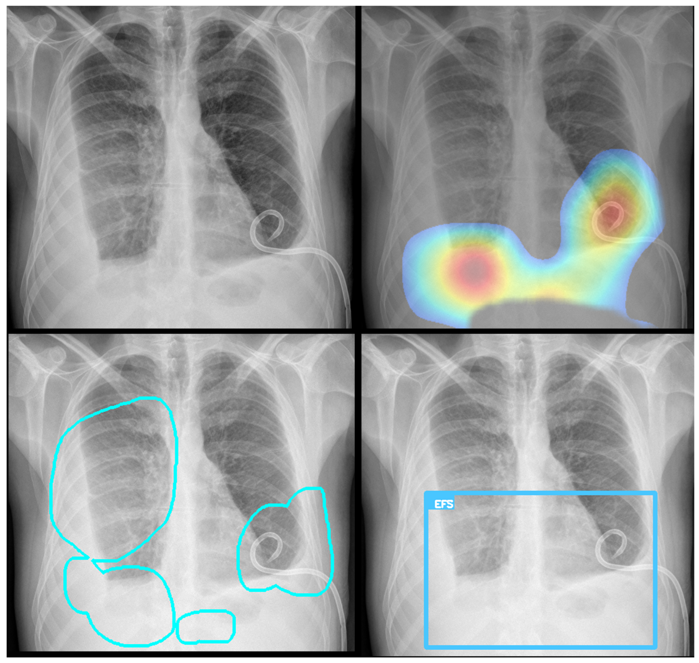 Diagnostics 15 02899 g003 Diagnostics 15 02899 g003