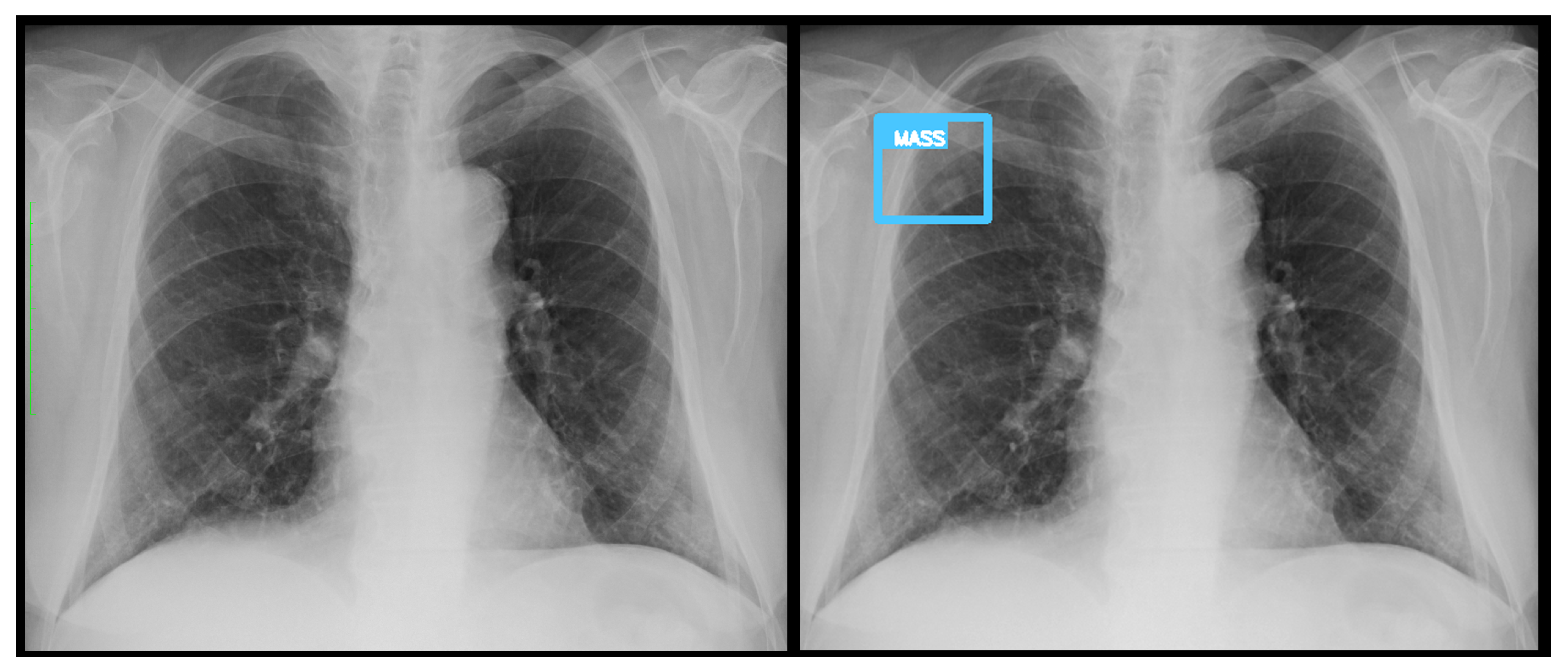 Diagnostics 15 02899 g004 Diagnostics 15 02899 g004