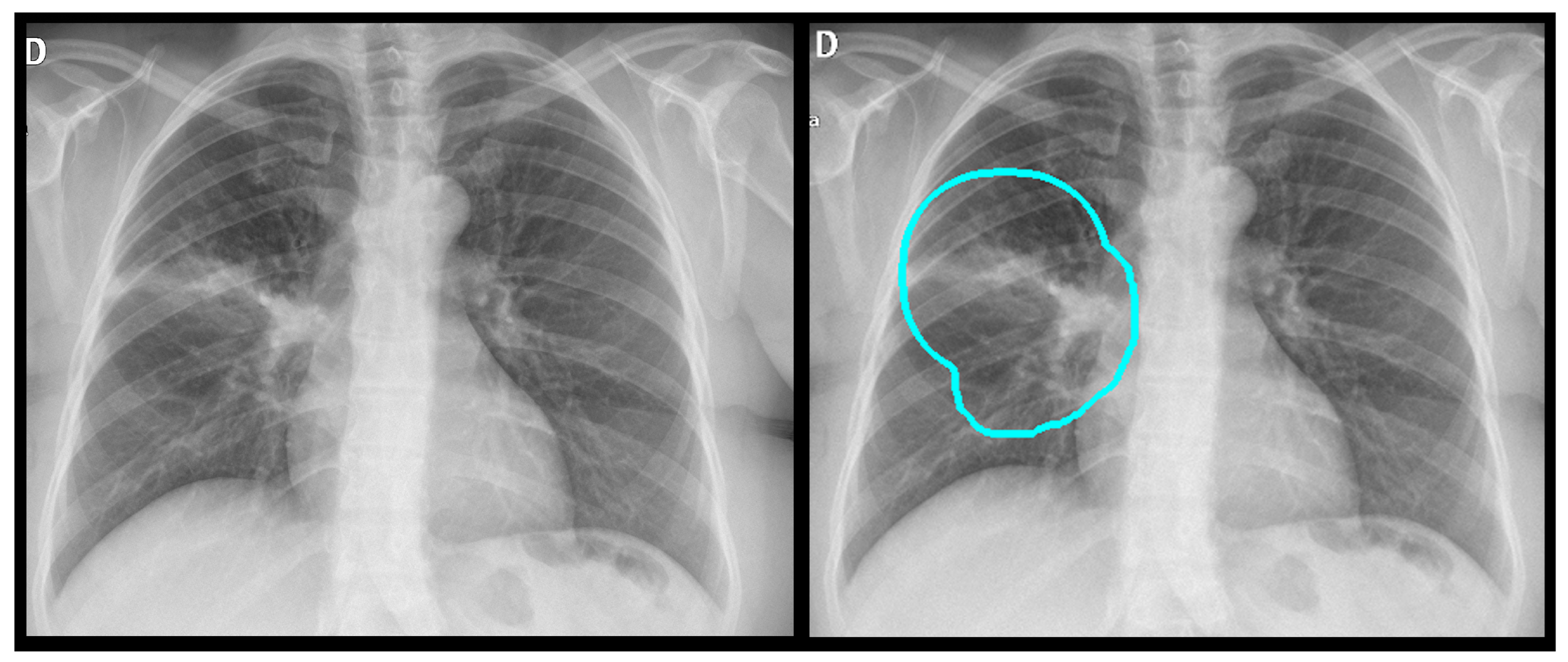 Diagnostics 15 02899 g005 Diagnostics 15 02899 g005