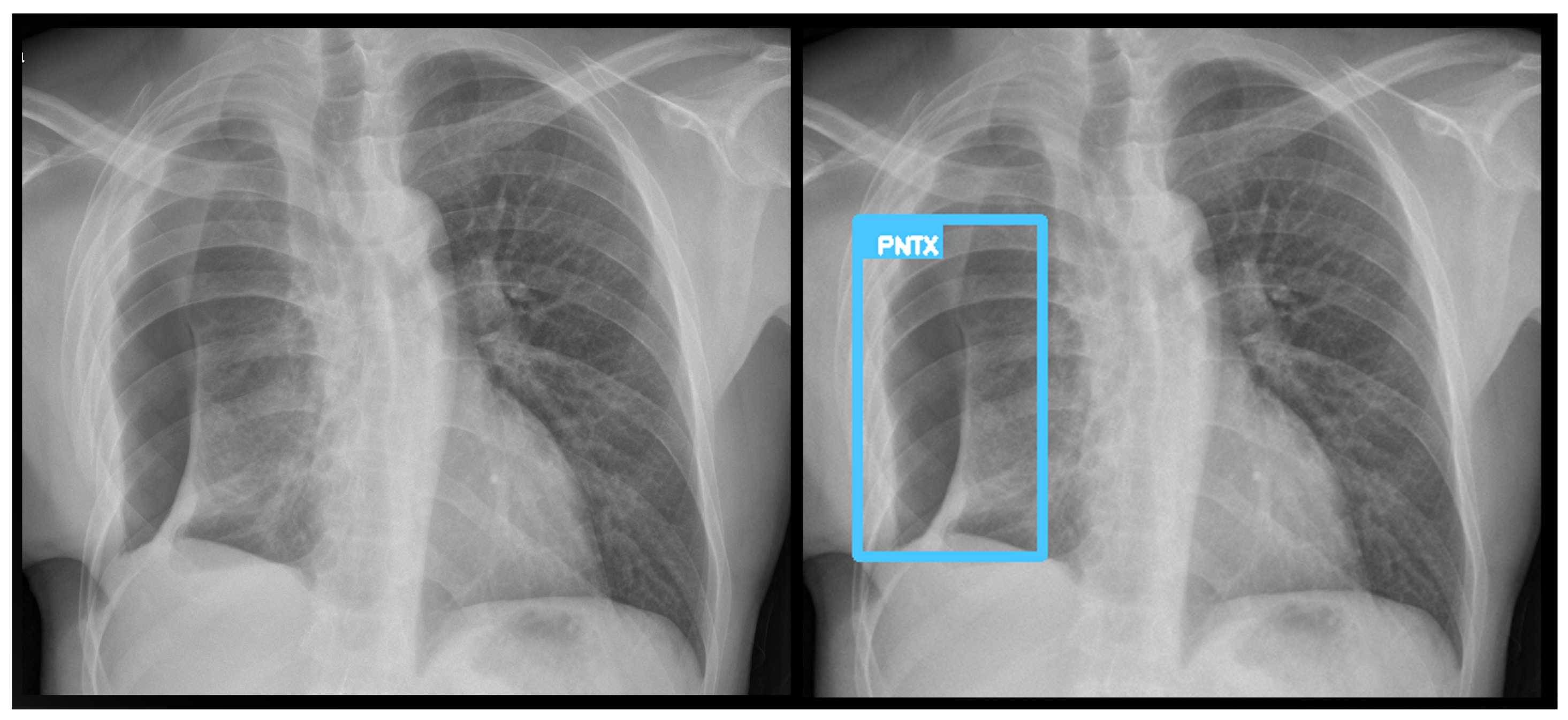Diagnostics 15 02899 g006 Diagnostics 15 02899 g006