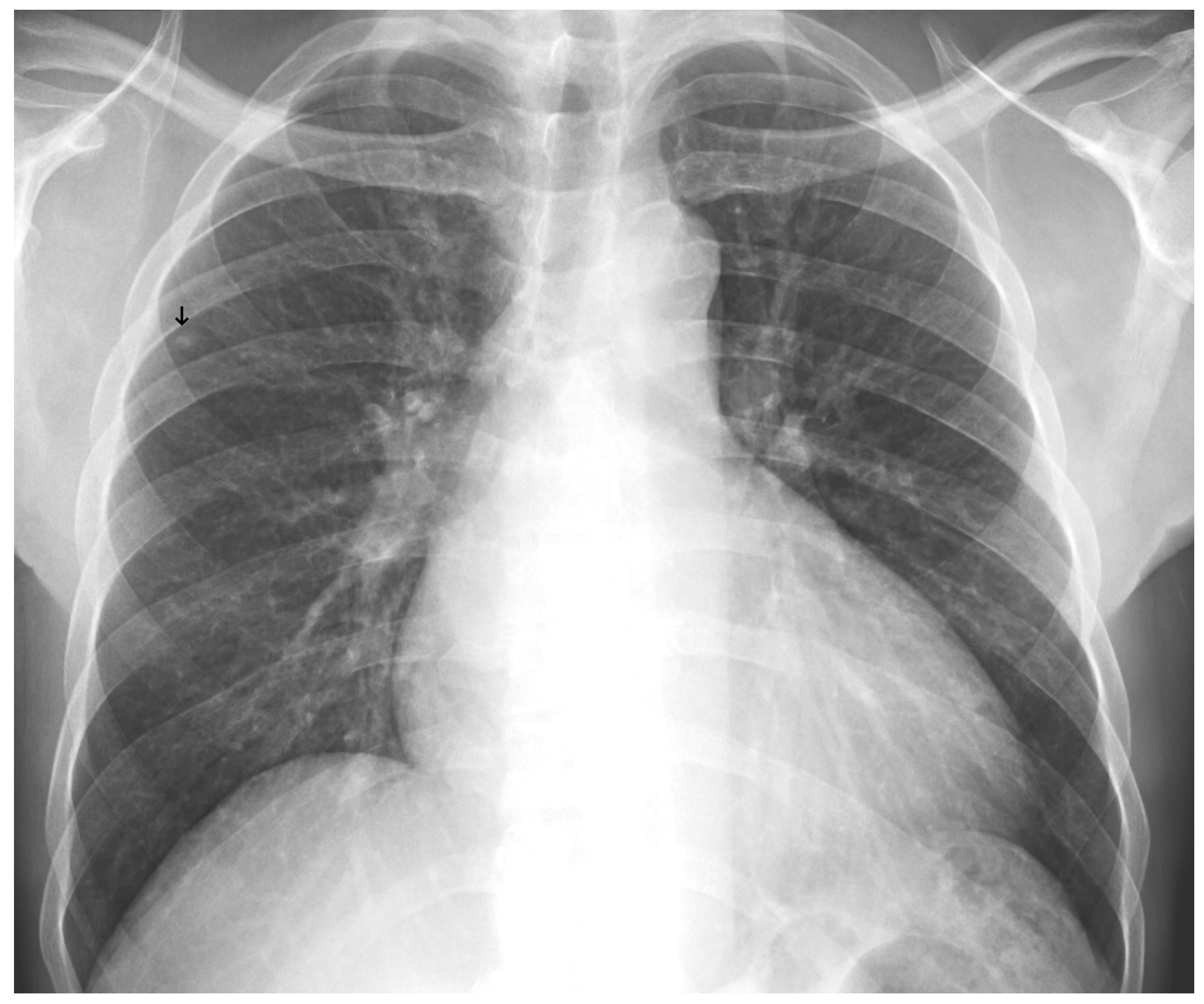 Diagnostics 15 02899 g009 Diagnostics 15 02899 g009