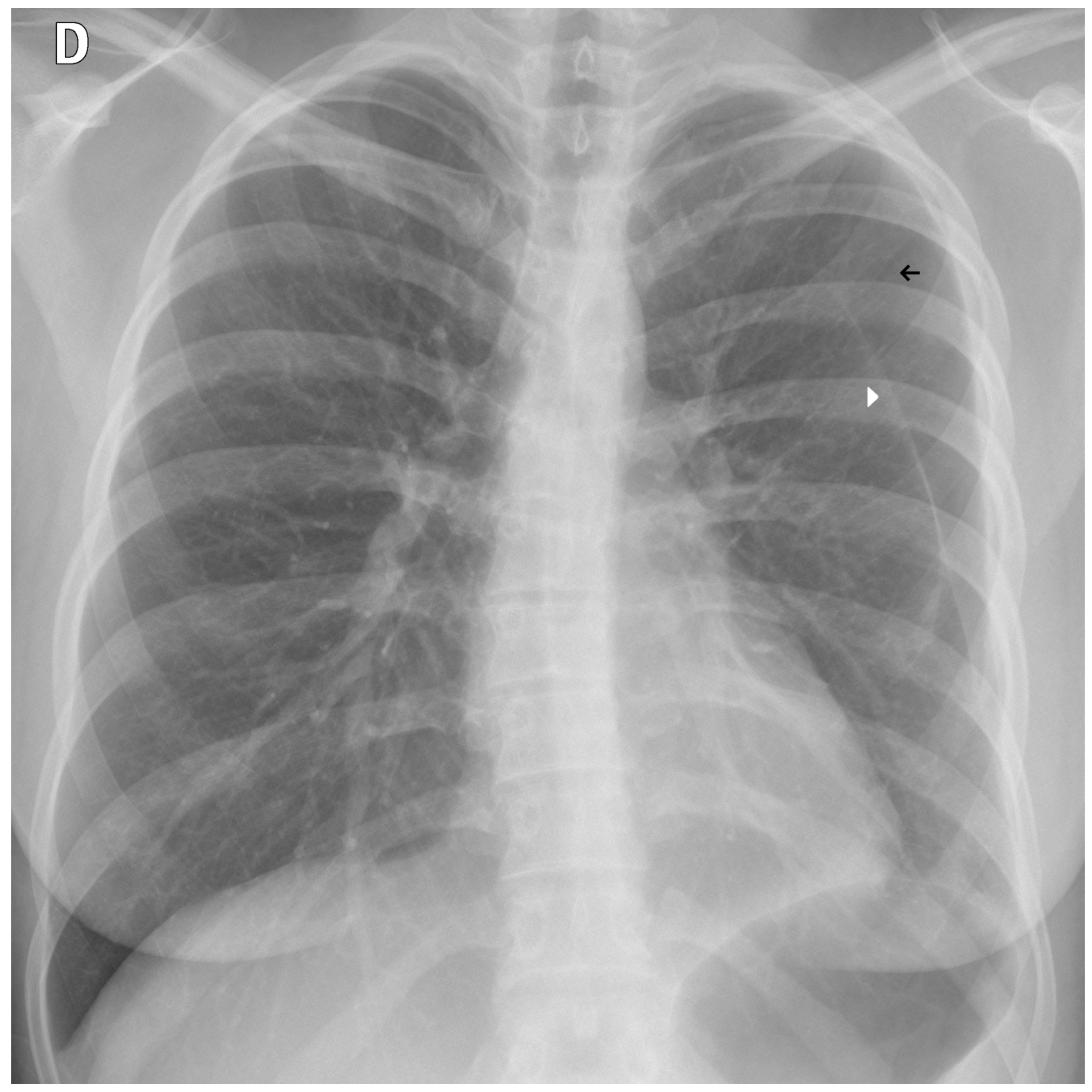 Diagnostics 15 02899 g011 Diagnostics 15 02899 g011