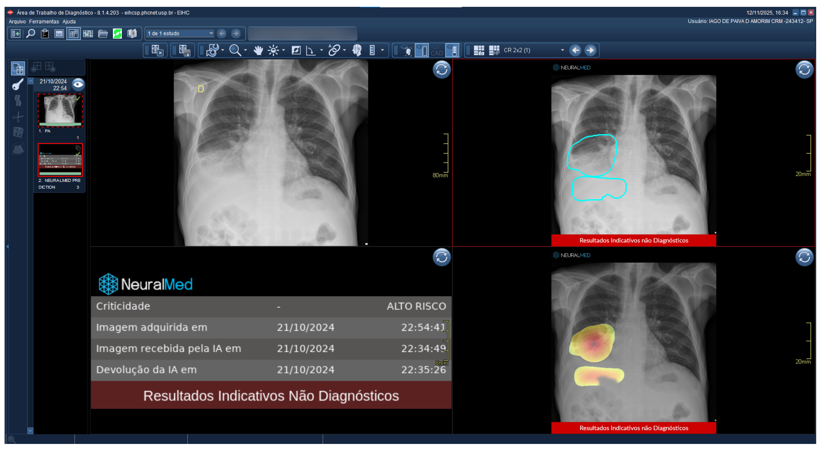 Diagnostics 15 02899 g012 Diagnostics 15 02899 g012