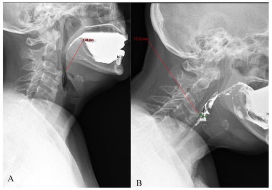 Diagnostics 15 03020 g005