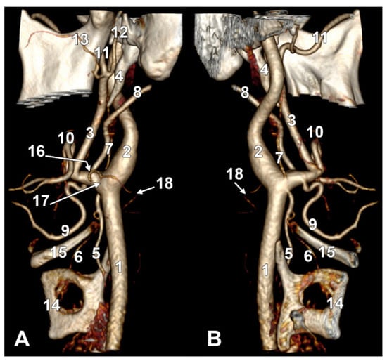 Diagnostics 15 03106 g011