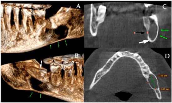 Diagnostics 15 03140 g002