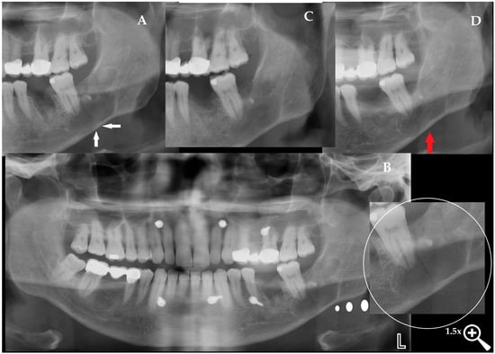Diagnostics 15 03140 g004
