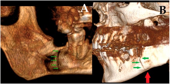 Diagnostics 15 03140 g005