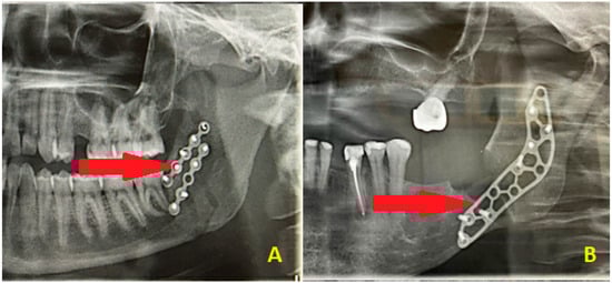 Diagnostics 15 03140 g006