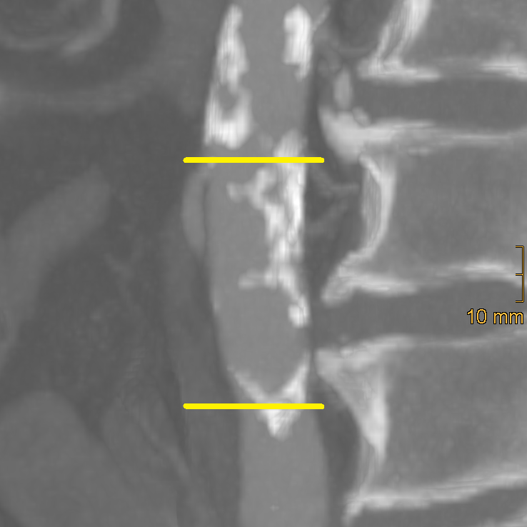 Diagnostics 15 03151 g001 Diagnostics 15 03151 g001