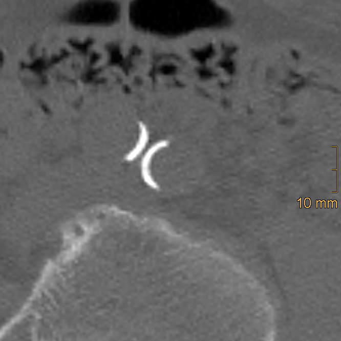 Diagnostics 15 03151 g003 Diagnostics 15 03151 g003