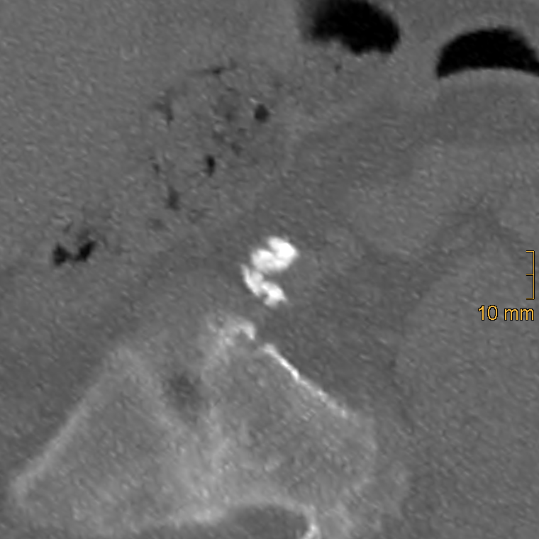 Diagnostics 15 03151 g004 Diagnostics 15 03151 g004