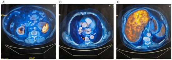 Diagnostics 15 03172 g001