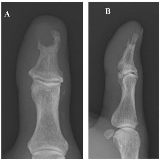 Diagnostics 15 03173 g001