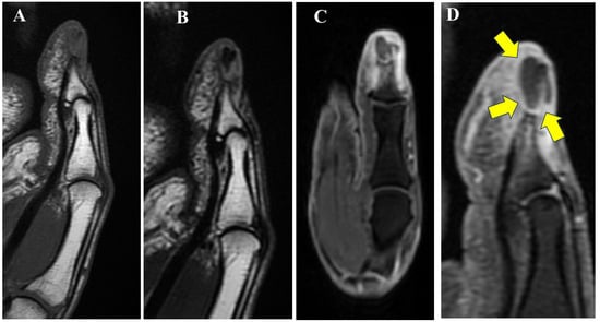 Diagnostics 15 03173 g002