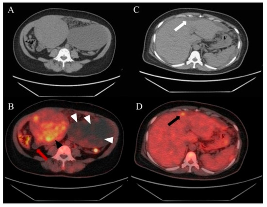 Diagnostics 15 03198 g001