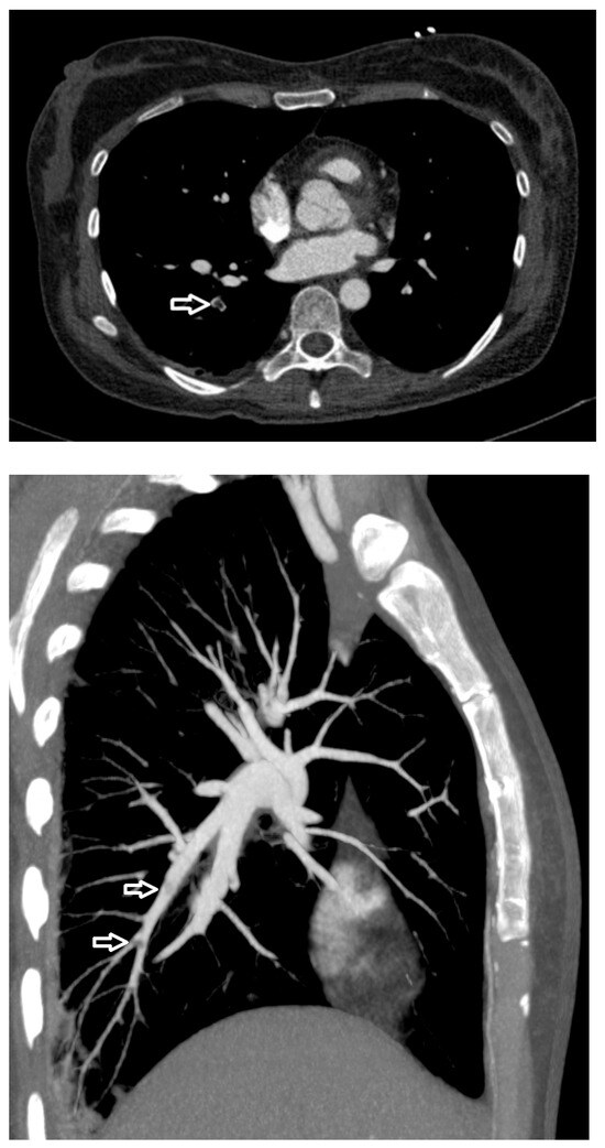 Diagnostics 15 03214 g002