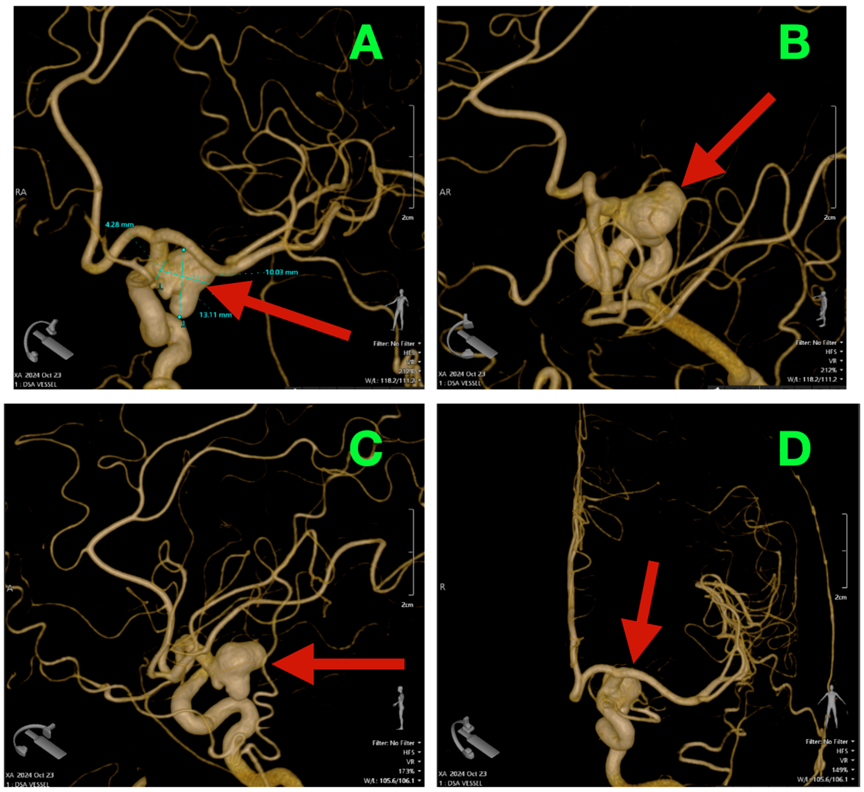 Diagnostics 16 00124 g002 Diagnostics 16 00124 g002
