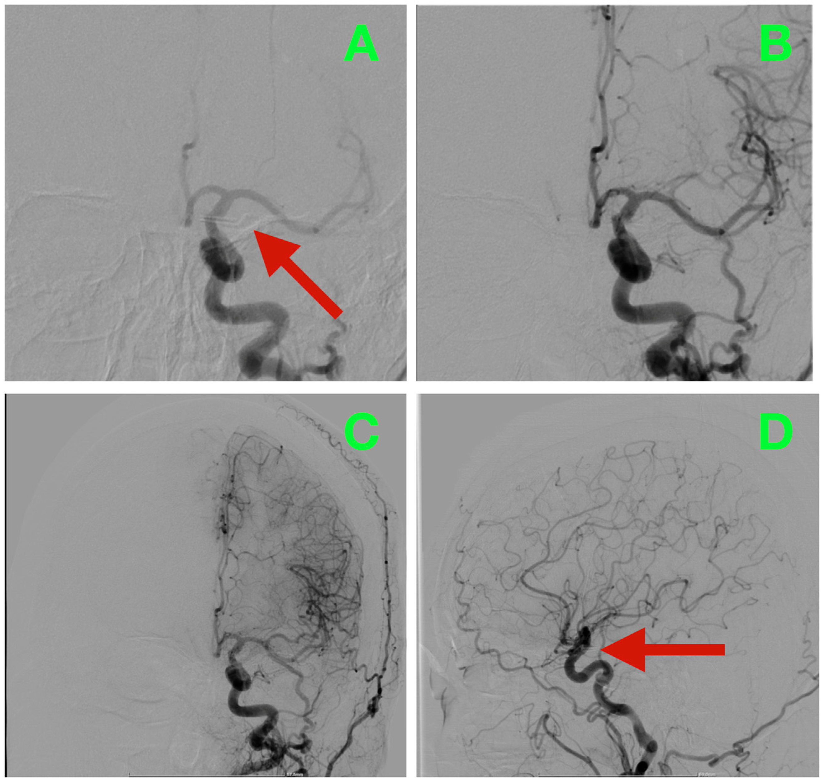 Diagnostics 16 00124 g003 Diagnostics 16 00124 g003