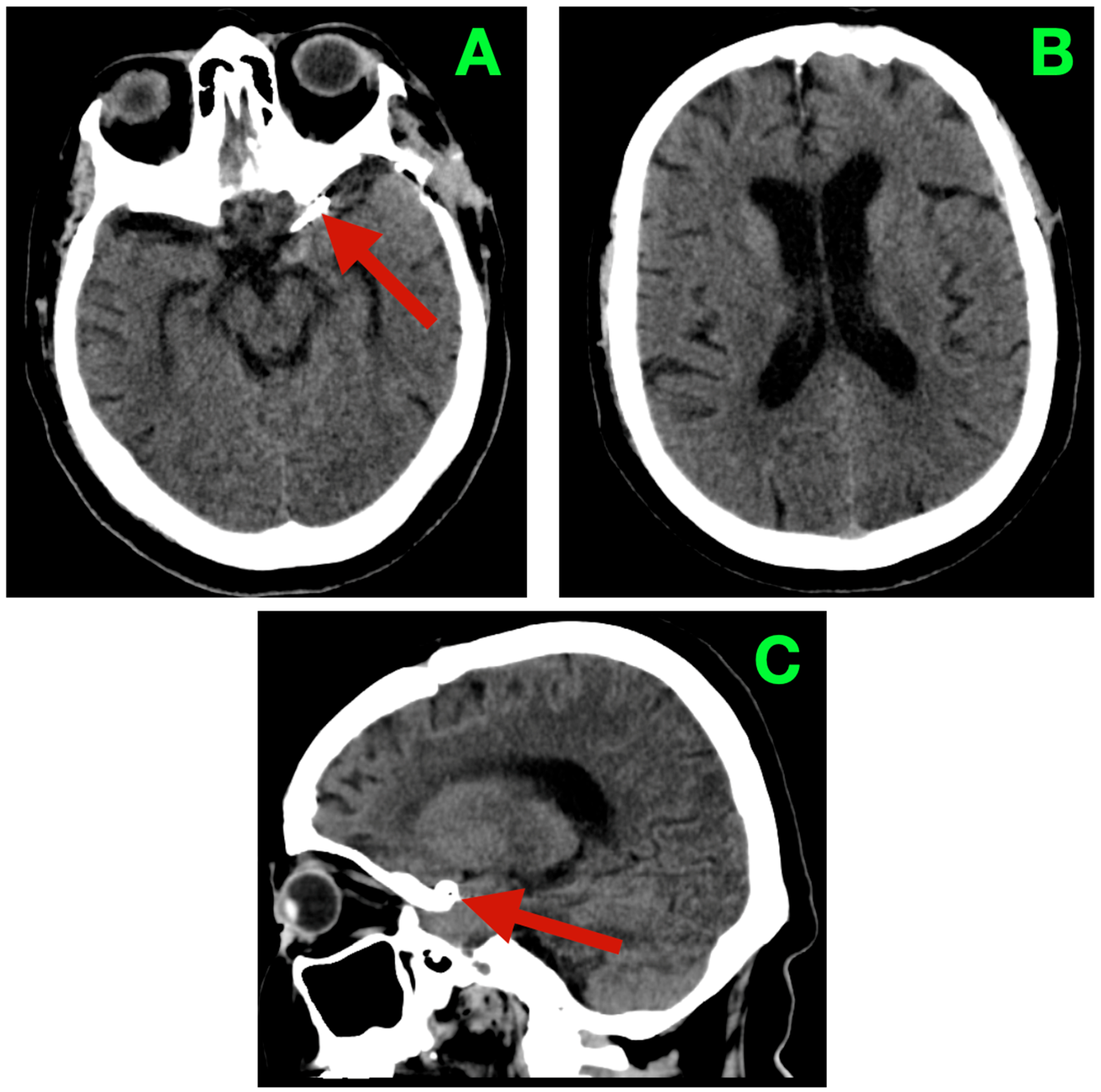 Diagnostics 16 00124 g004 Diagnostics 16 00124 g004