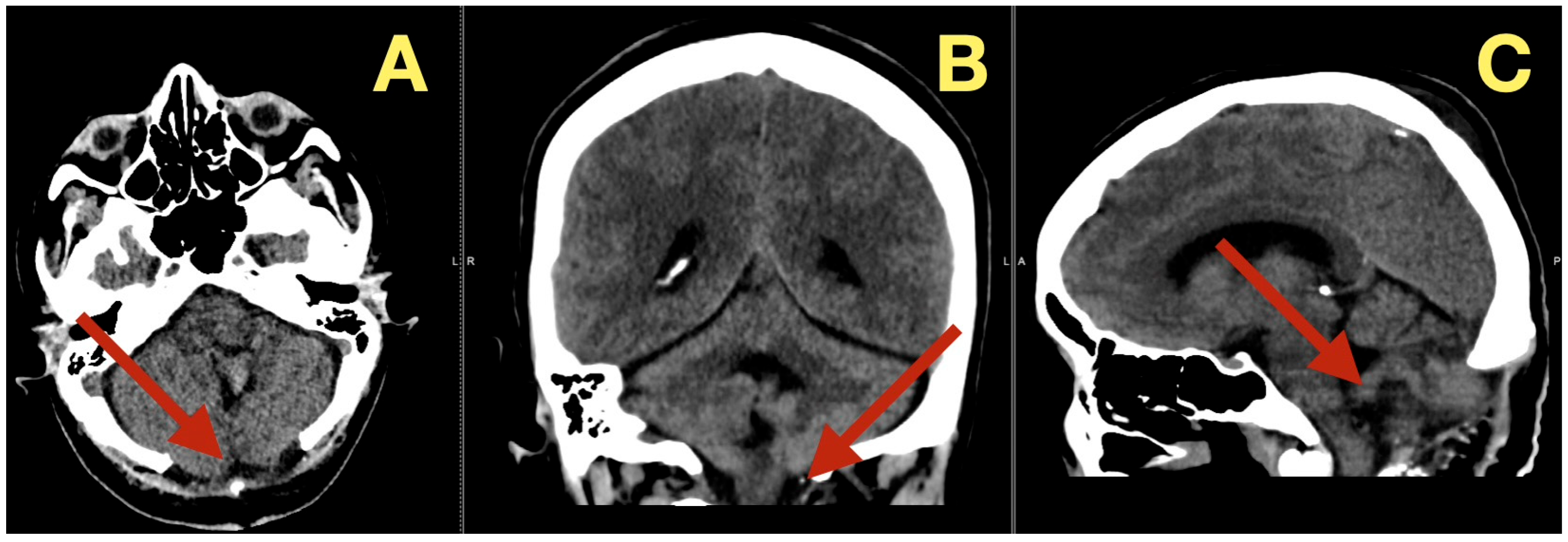 Diagnostics 16 00129 g003 Diagnostics 16 00129 g003