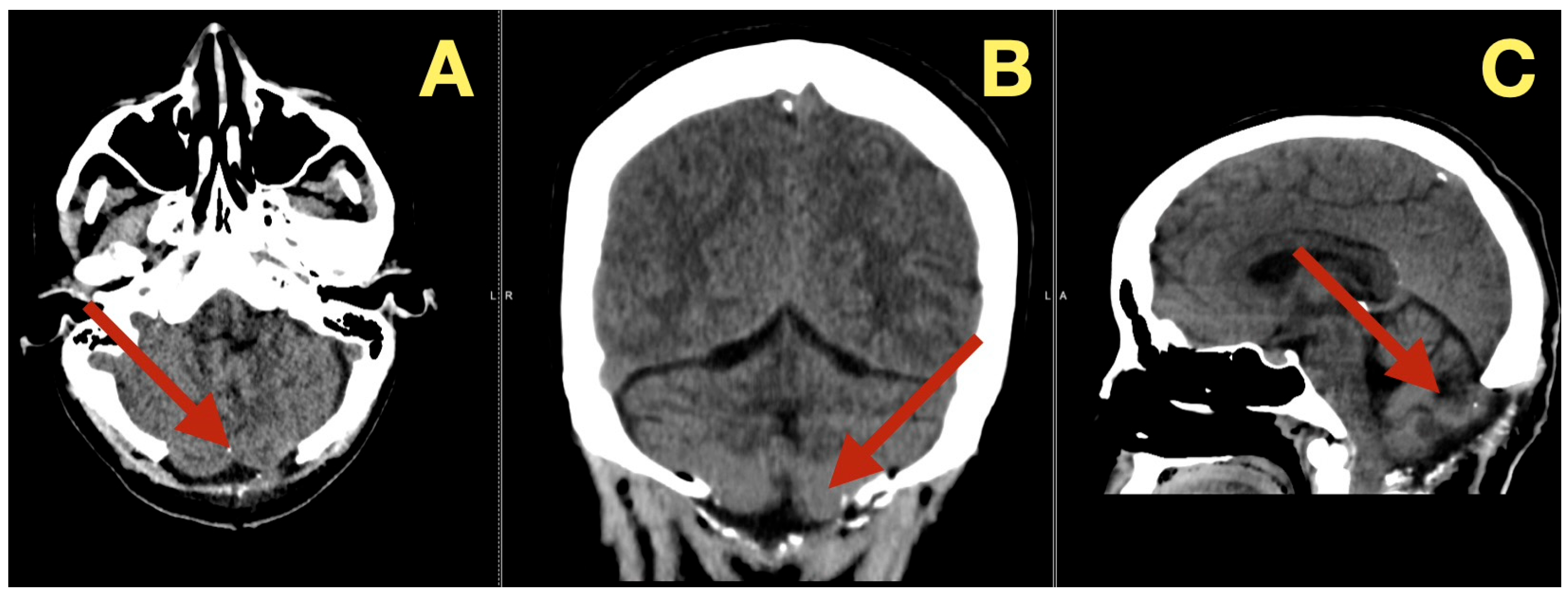 Diagnostics 16 00129 g004 Diagnostics 16 00129 g004