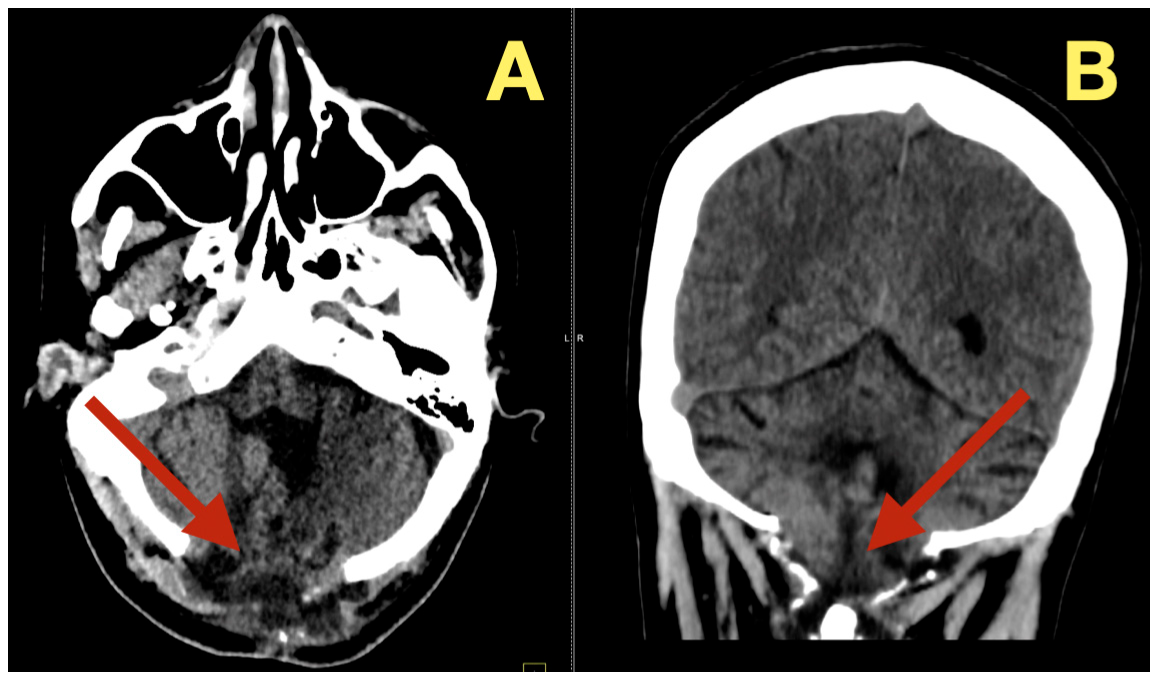 Diagnostics 16 00129 g005 Diagnostics 16 00129 g005