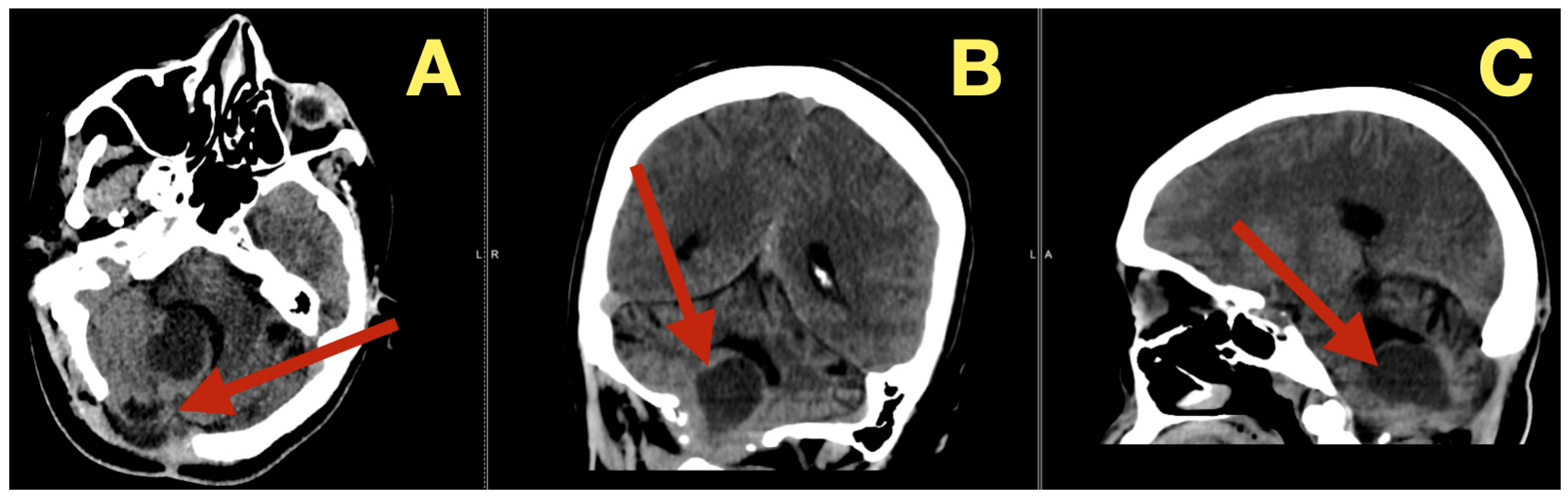 Diagnostics 16 00129 g006 Diagnostics 16 00129 g006