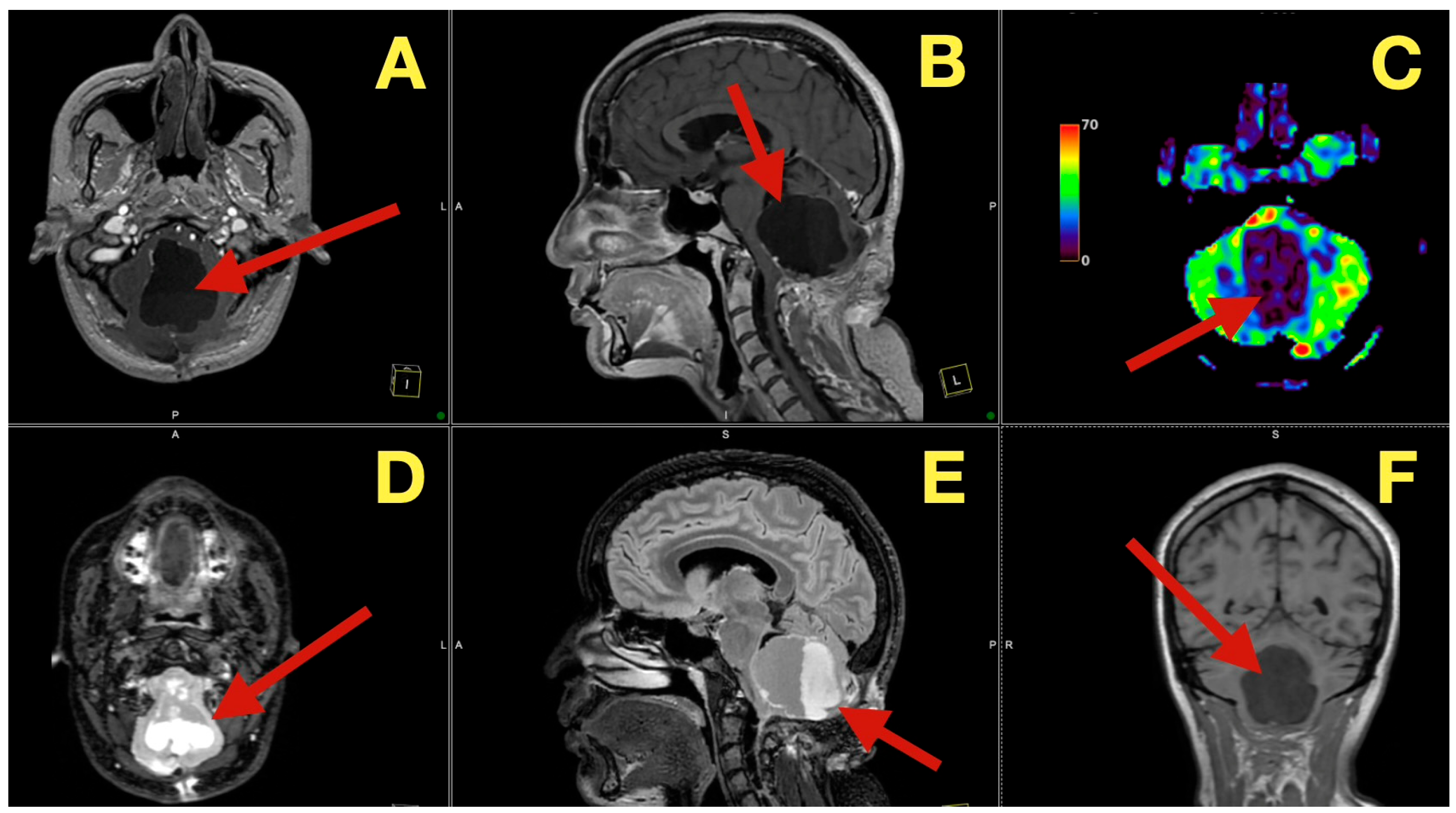 Diagnostics 16 00129 g007 Diagnostics 16 00129 g007