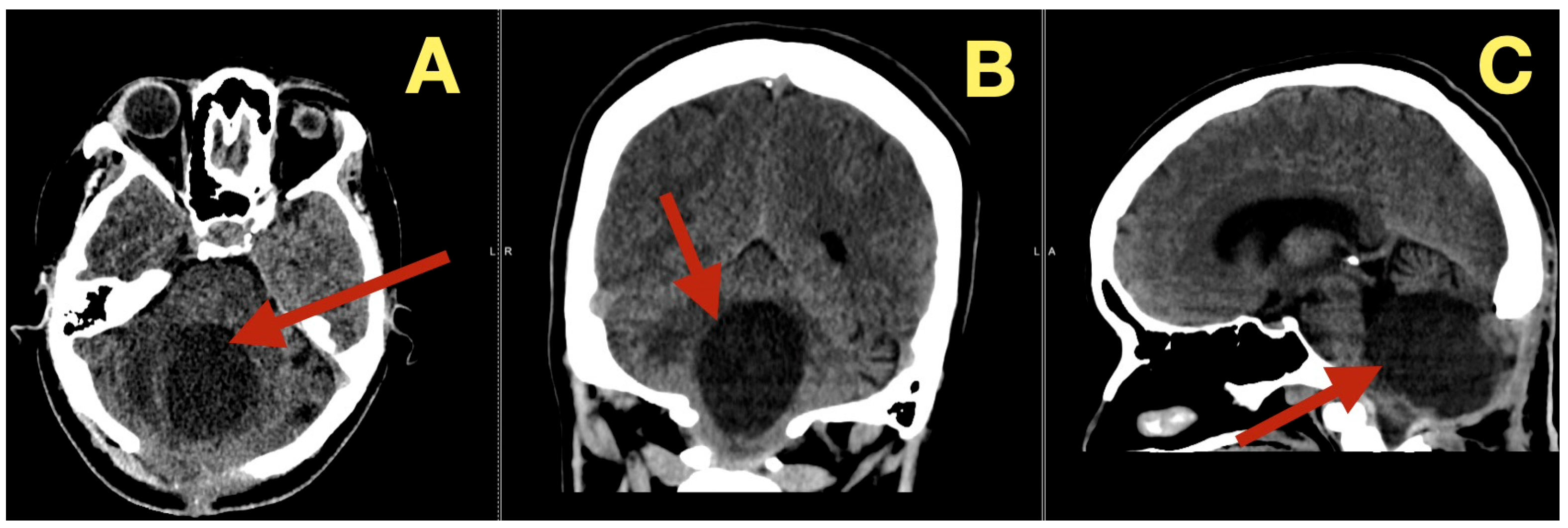 Diagnostics 16 00129 g008 Diagnostics 16 00129 g008