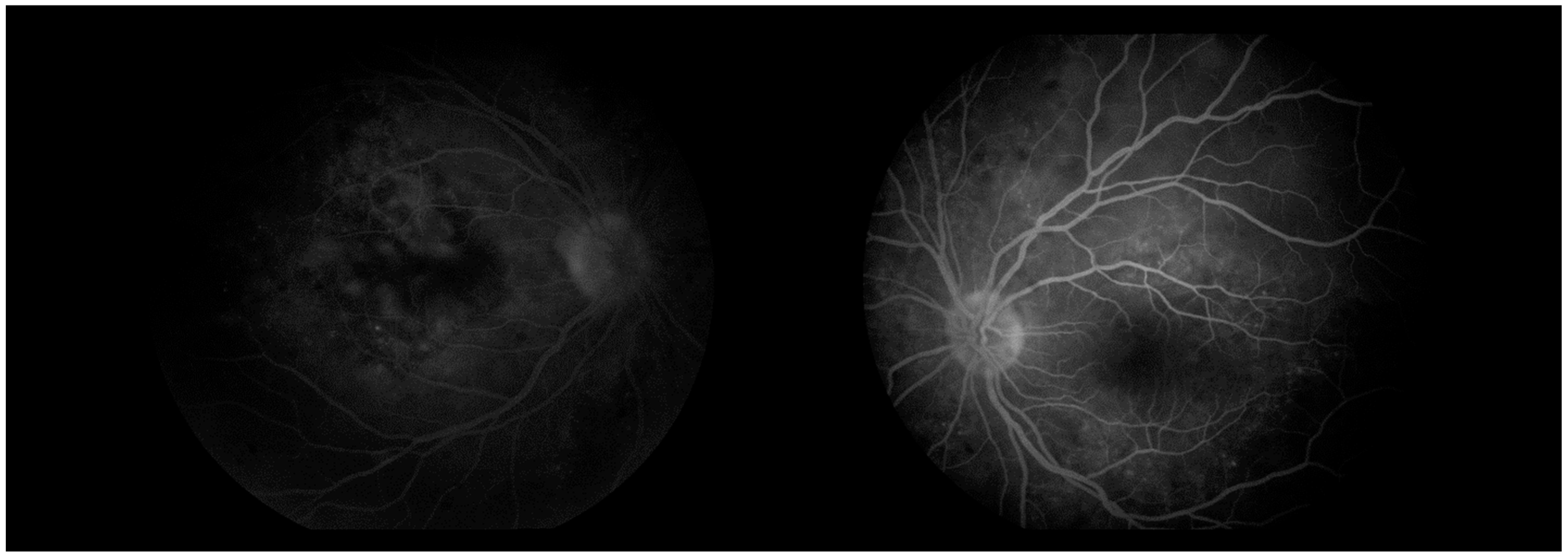 Diagnostics 16 00141 g009 Diagnostics 16 00141 g009