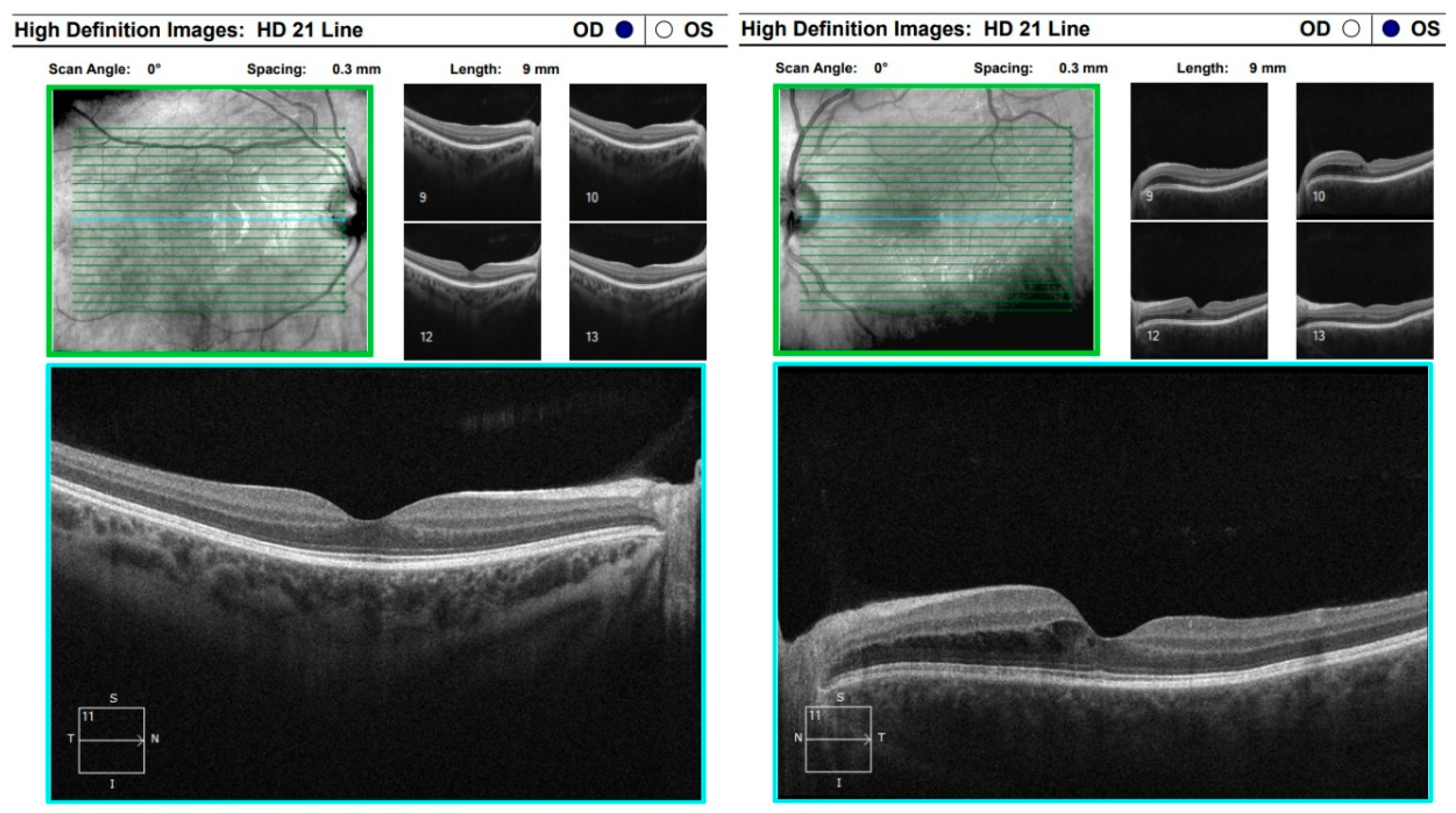 Diagnostics 16 00141 g013 Diagnostics 16 00141 g013