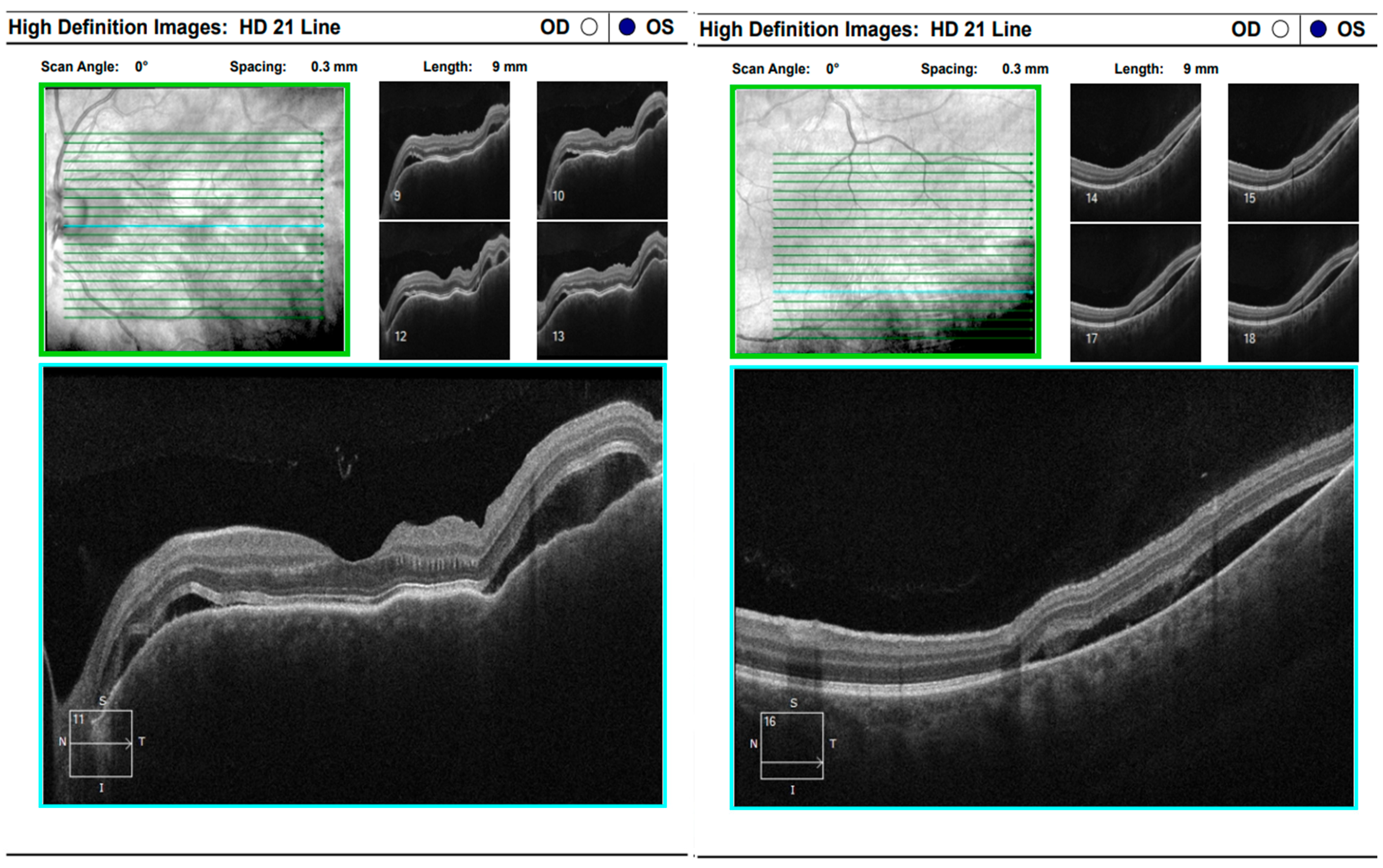 Diagnostics 16 00141 g016 Diagnostics 16 00141 g016