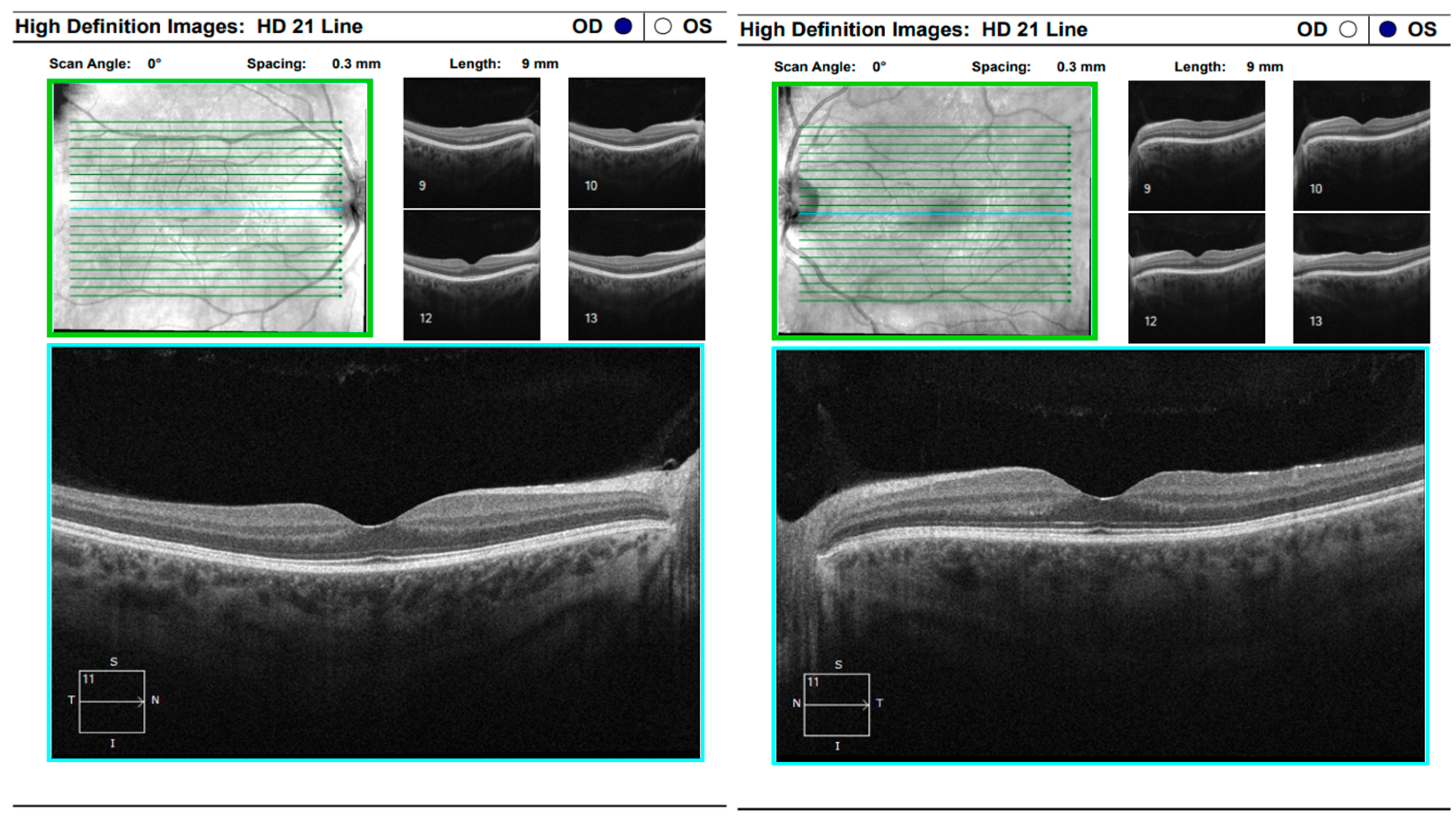 Diagnostics 16 00141 g017 Diagnostics 16 00141 g017