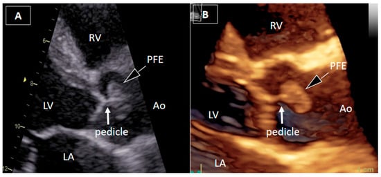 Diagnostics 16 00168 g001