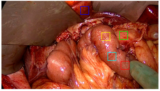 Diagnostics 16 00176 g002