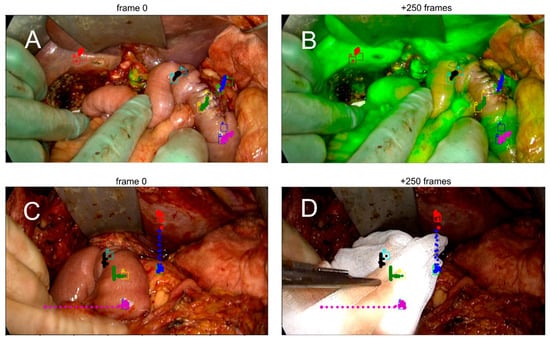 Diagnostics 16 00176 g003
