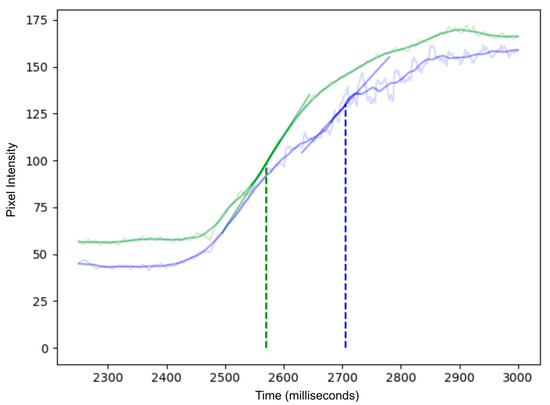 Diagnostics 16 00176 g004