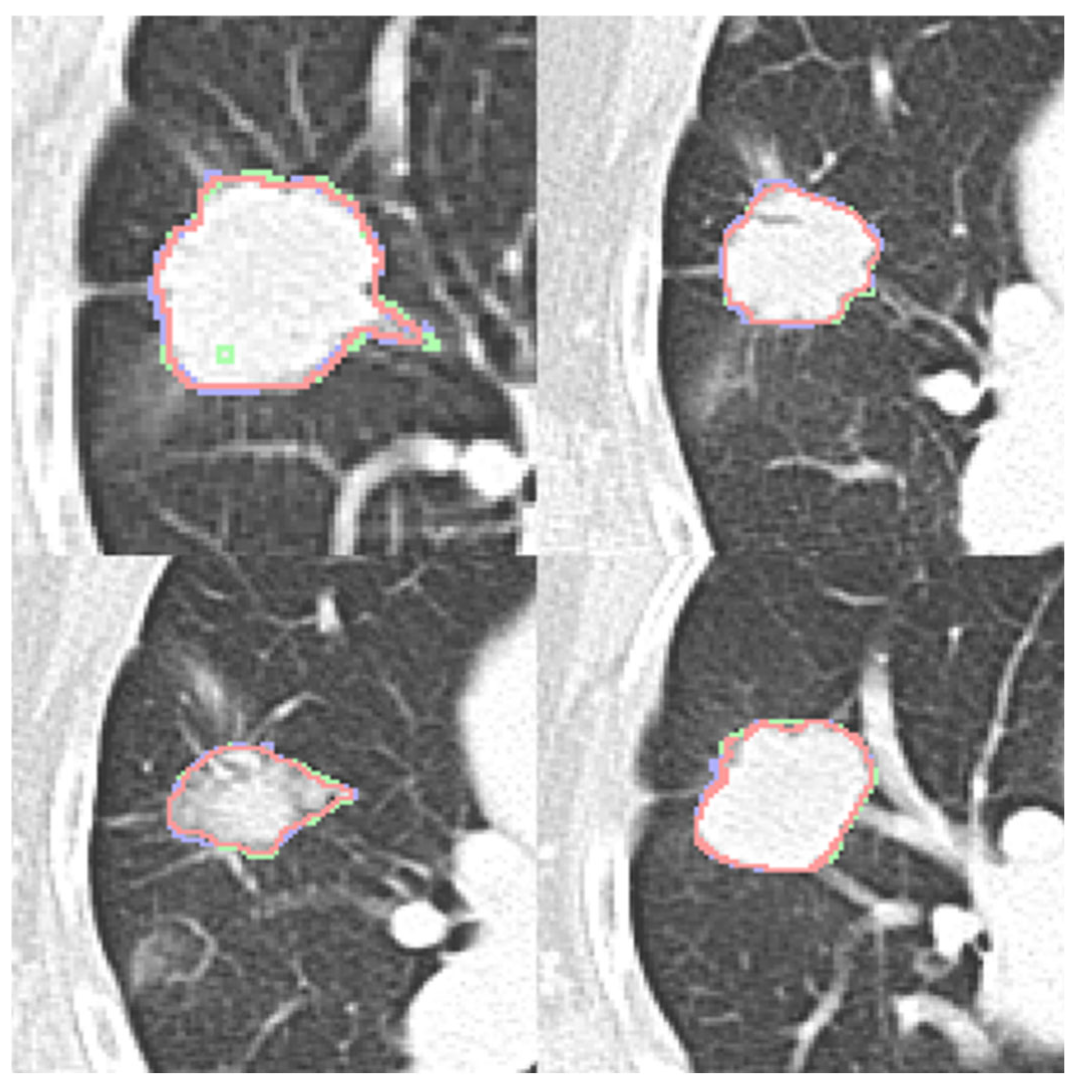 Diagnostics 16 00186 g003 Diagnostics 16 00186 g003
