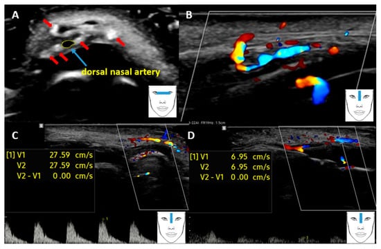 Diagnostics 16 00271 g002