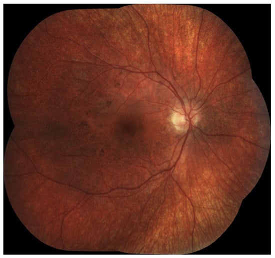 Diagnostics 16 00295 g001