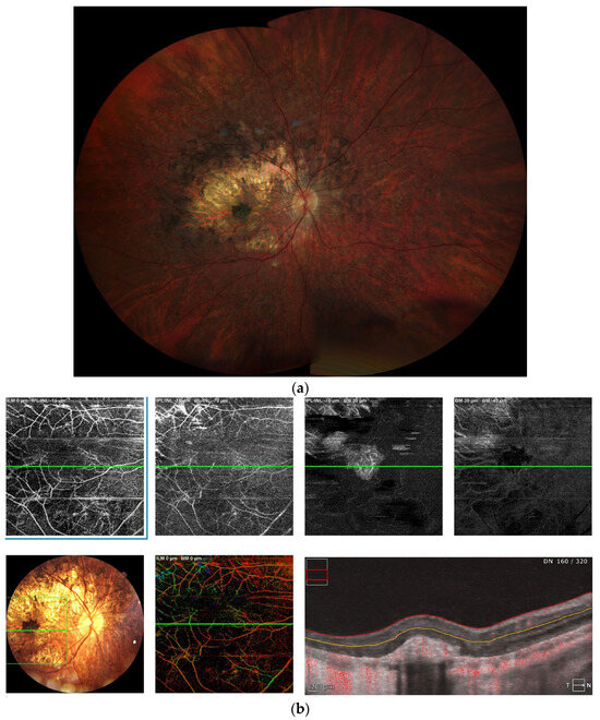 Diagnostics 16 00295 g002a