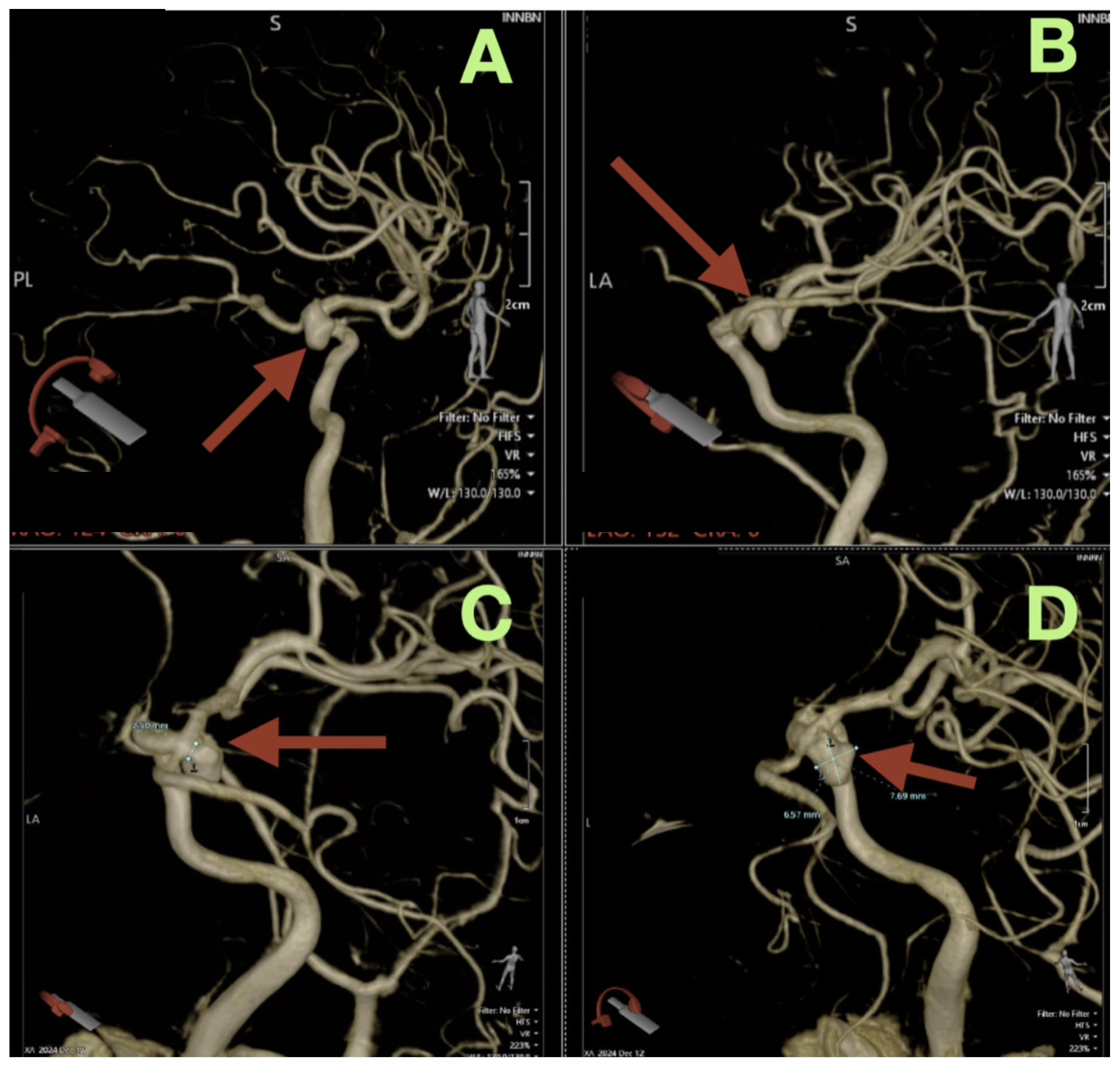 Diagnostics 16 00307 g002 Diagnostics 16 00307 g002