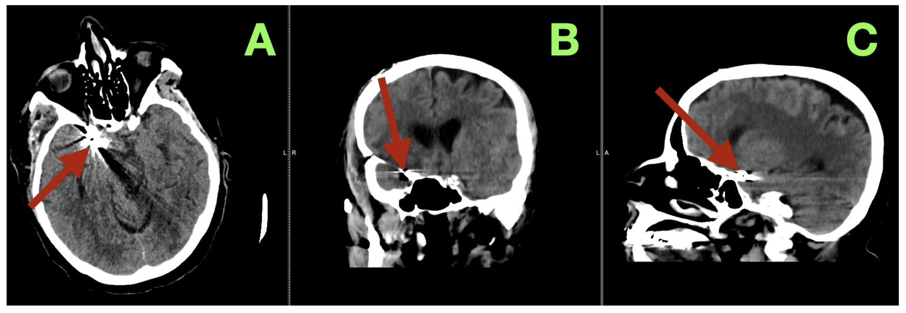 Diagnostics 16 00307 g003 Diagnostics 16 00307 g003