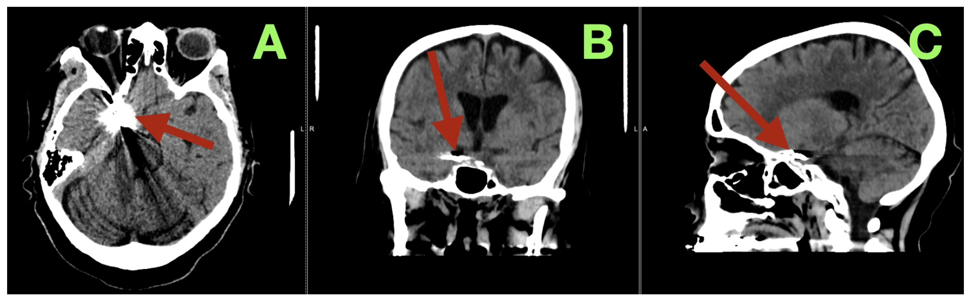 Diagnostics 16 00307 g004 Diagnostics 16 00307 g004